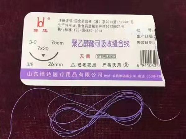 聚乙醇酸可吸收缝合线
