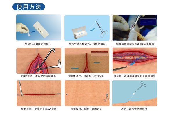带针肽镍记忆合金缝合线(鲁械广审(文)第260914-15634号)